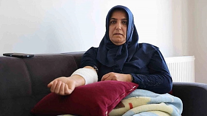 Köpek Dehşetini Yaşayan Kadın Yaşadıklarını Anlattı
