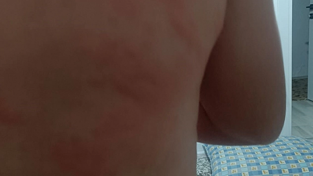 Elazığ'da böcek ısırması nedeniyle hastaneye kaldırıldı.