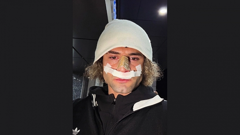 Elazığspor'a Kötü Haber: Fuat Bavuk'un Burnu Kırıldı